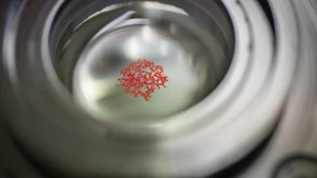 Mehr Mikroplastik in Organen