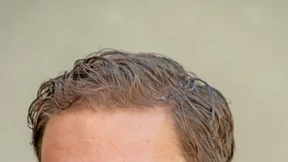 100 Prozent sind selten