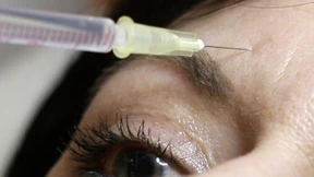 Schönheitsoperationen werden in Deutschland abermals stärker nachgefragt