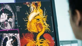 Hauptschlagader als Organ eingestuft