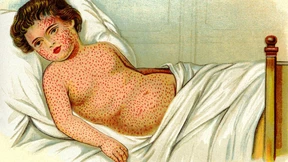 „Warum jemanden verletzen, der kerngesund ist?“