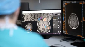 Warum das Fundament vieler KI-Systeme wackelig ist