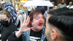 Ermittlungsverfahren gegen Polizisten nach Faustschlag eingeleitet