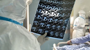 Patient 1, eine Warnung und der Zoff der Ärzte