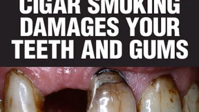 Schockfotos schrecken Raucher ab