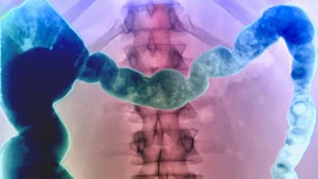 Eine Krankheit - viele Erklärungen