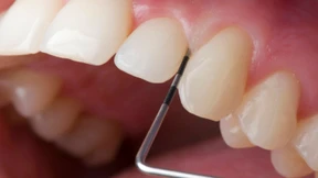 Gentest beim Zahnarzt?