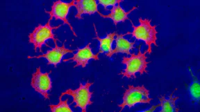 Washington erhebt Zivilklage wegen Stammzelltherapien