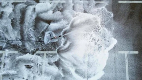 Warum wir uns mit den Bakterien in uns versöhnen müssen