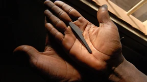 Mädchen werden seltener Opfer von Beschneidungen