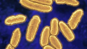 Darobactine könnten gegen Lungenentzündung helfen