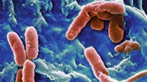 Mehr als 10.000 Todesfälle pro Jahr