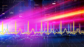 Die stillen Verbündeten des Hochfrequenzhandels