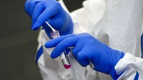 569 neue Corona-Infektionen in Deutschland