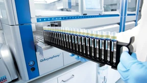 Qiagen-Aktien auf höchstem Stand seit 19 Jahren