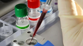 Gestorben an einer Schürfwunde