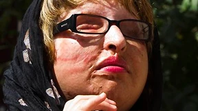 Blinde Iranerin verzichtet auf Vergeltung