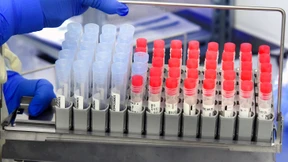 Europa kapituliert vor den Virusvarianten