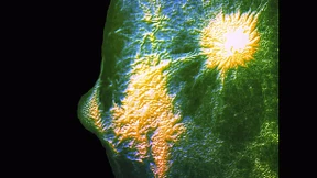 Vorbeugen ist immer noch nicht sexy