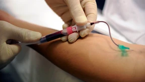 Turbulenzen um Blutbestrahlung