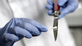 Messerstecher muss in die Psychiatrie