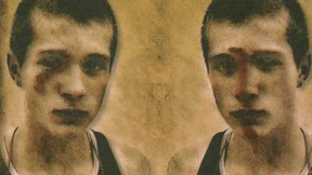 Blut an Gitarristenhänden