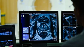 Mehr Erfolg bei Prostata-Operation