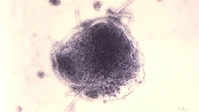 Impfgegner verliert 100.000-Euro-Wette