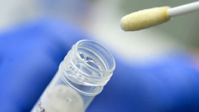 Inzidenz auf neuem Höchststand