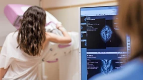 Wie sinnvoll ist das Brustkrebs-Screening?