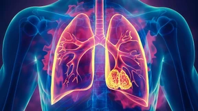 Wie personalisierte Therapie in die Versorgung kommt – und was noch fehlt