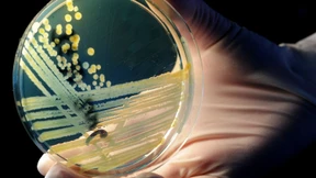 Mehrere Tote nach Ehec-Ausbruch in belgischen Seniorenheimen