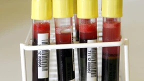 Blut-Gentest als Kassenleistung?