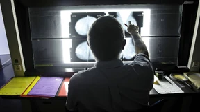 Erhöht eine Hormonbehandlung das Brustkrebsrisiko?