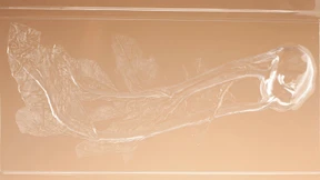 Wie der Kohlrabi sein Kunststoffhülle bekam