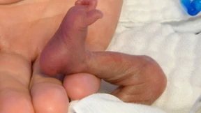 Frühchen brauchen Hautkontakt – noch vor dem Brutkasten