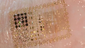 Elektronisches Tattoo liefert die Diagnose