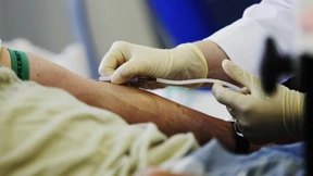 Blutspender hatte Infektion mit Usutu-Virus hinter sich