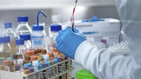 So viel verdient ein Pathologe