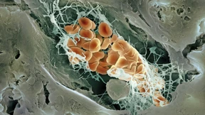 Hilferufe aus den Blutgefäßen