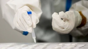 Wann kommt endlich der Schnelltest für den Laien?