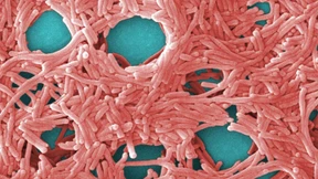 Beim Legionellen-Check blickt keiner durch