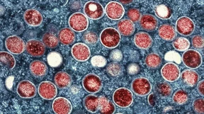 Affenpocken breiten sich im Kongo aus