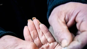 Elend soll sichtbar bleiben