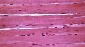 Sind energielose Muskeln die Ursache für Long Covid?