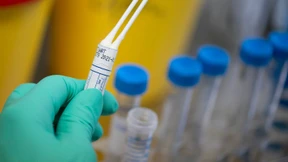 Teste mich, wer kann