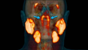Neues Organ im Rachen entdeckt