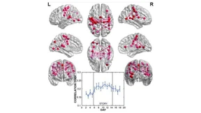 Die Roman-Verschaltung 