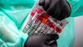 Delta breitet sich schnell in Deutschland aus