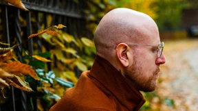 Wie es ist, wenn Mann seine Haare verliert